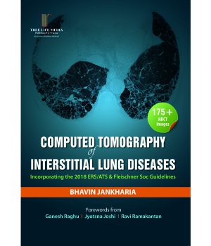 Computed Tomography of Interstitial Lung Diseases