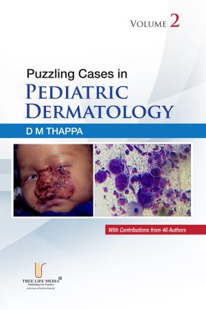 Puzzling Cases in Pediatric Dermatology Volume 2