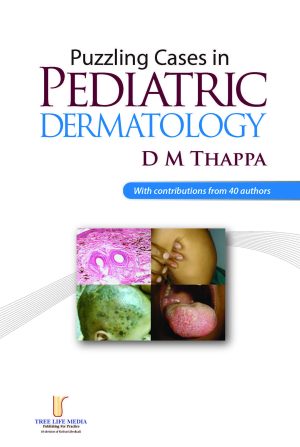 Puzzling Cases in Pediatric Dermatology Volume 1