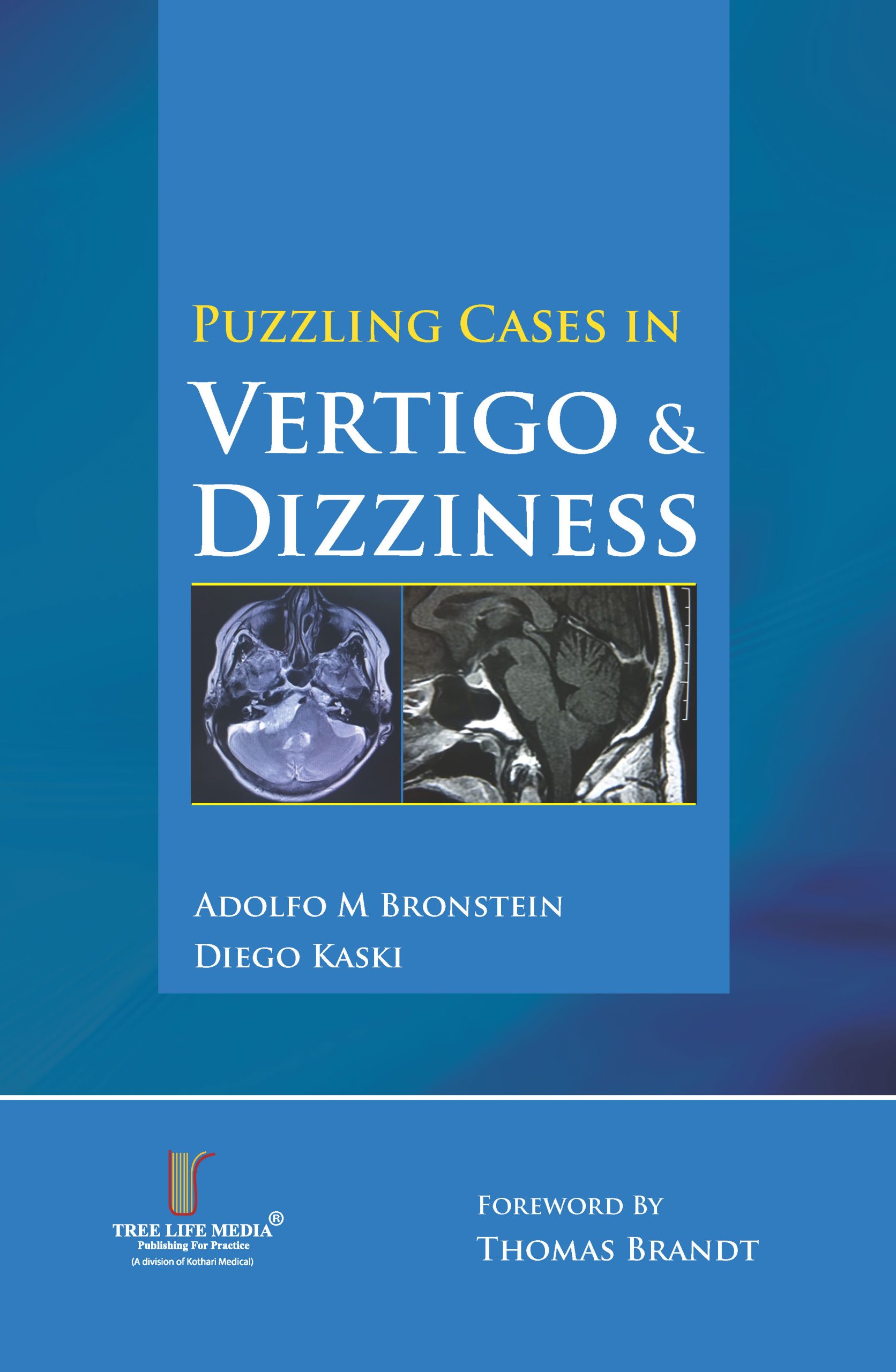 Puzzling Cases in Vertigo & Dizziness