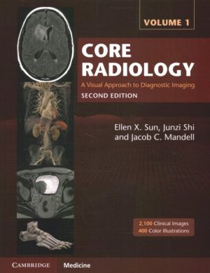 Core Radiology: A Visual Approach to Diagnostic Imaging