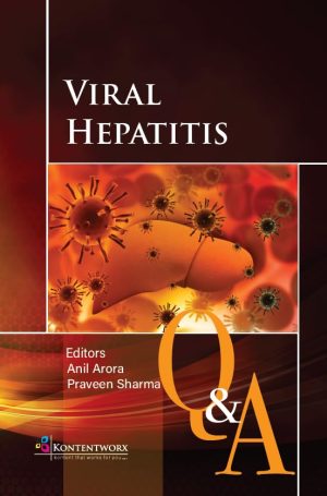 Viral Hepatitis