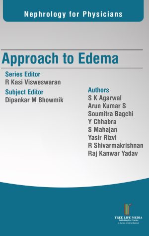 Nephrology for Physicians - Approach to Edema