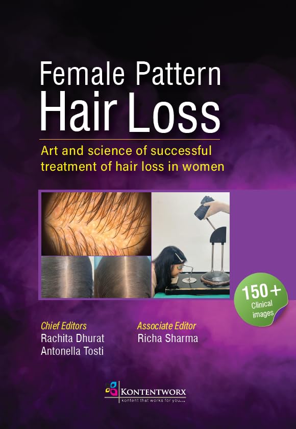 Female Pattern Hair Loss
